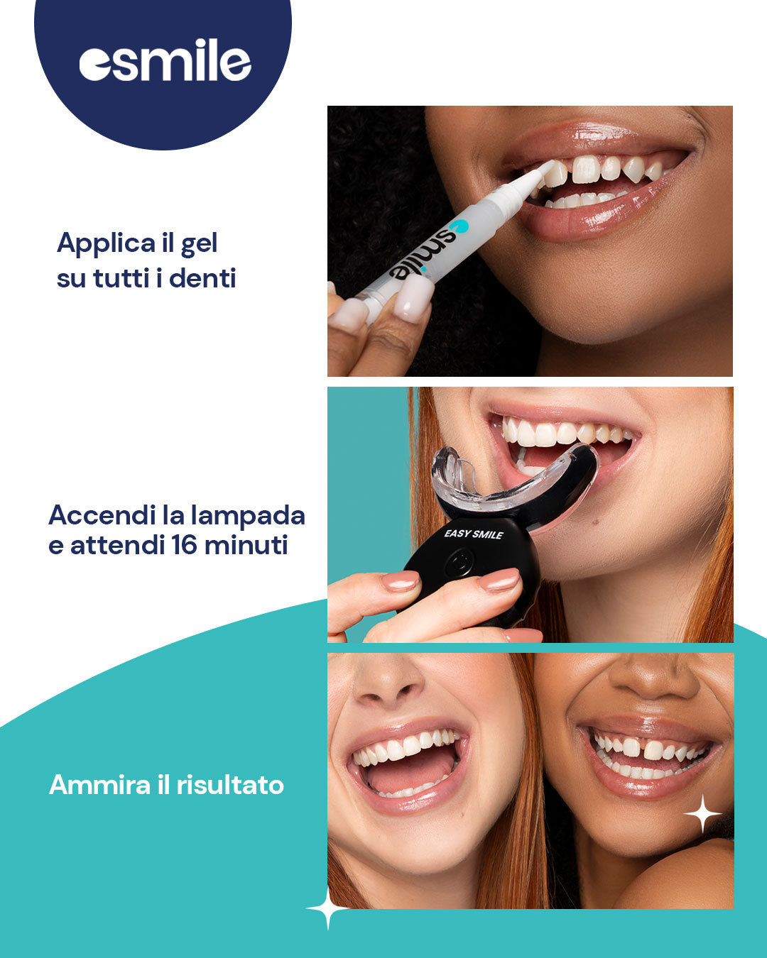 Kit Sbiancante per Denti Professionale