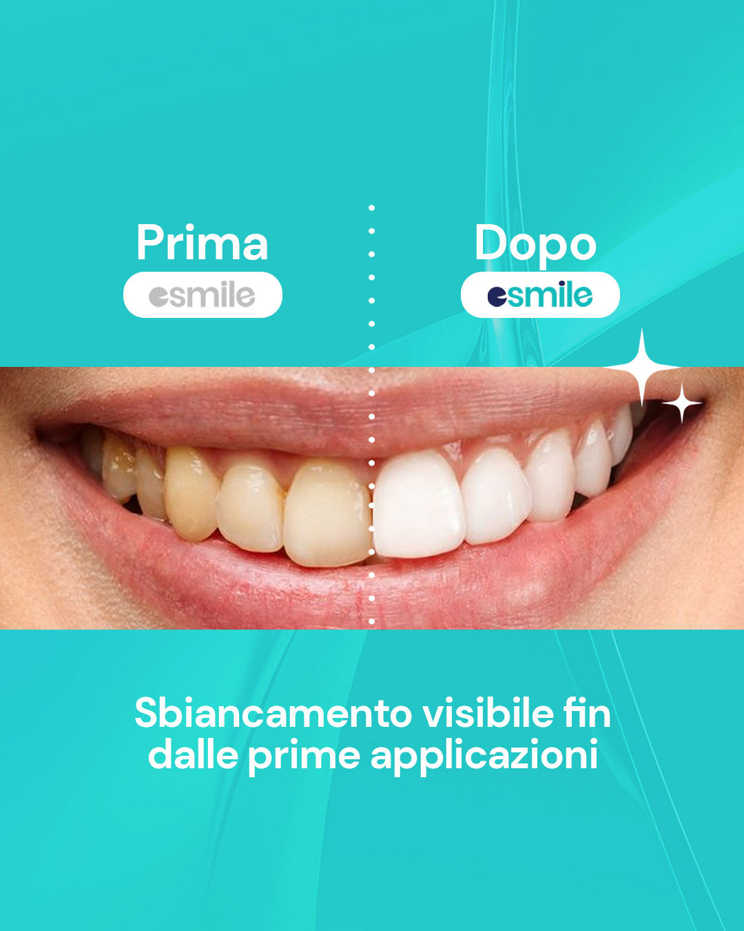 Polvere Sbiancante al Carbone Attivo 30g